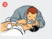 Defibrillator anwenden