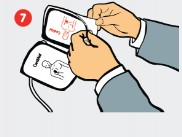 Elektroden platzieren